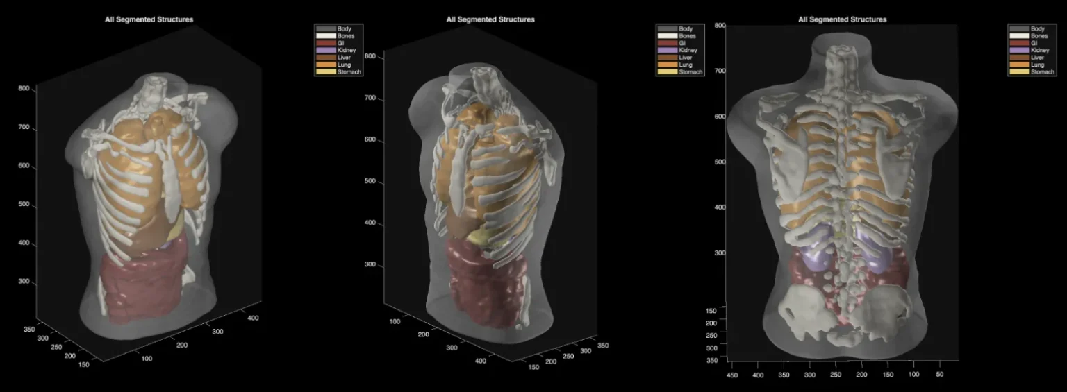 Midjourney avança e lança scanner corporal completo por ultrassom com qualidade semelhante a ressonância